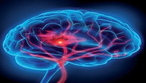 Neurocirug&iacute;a / Neurotrauma